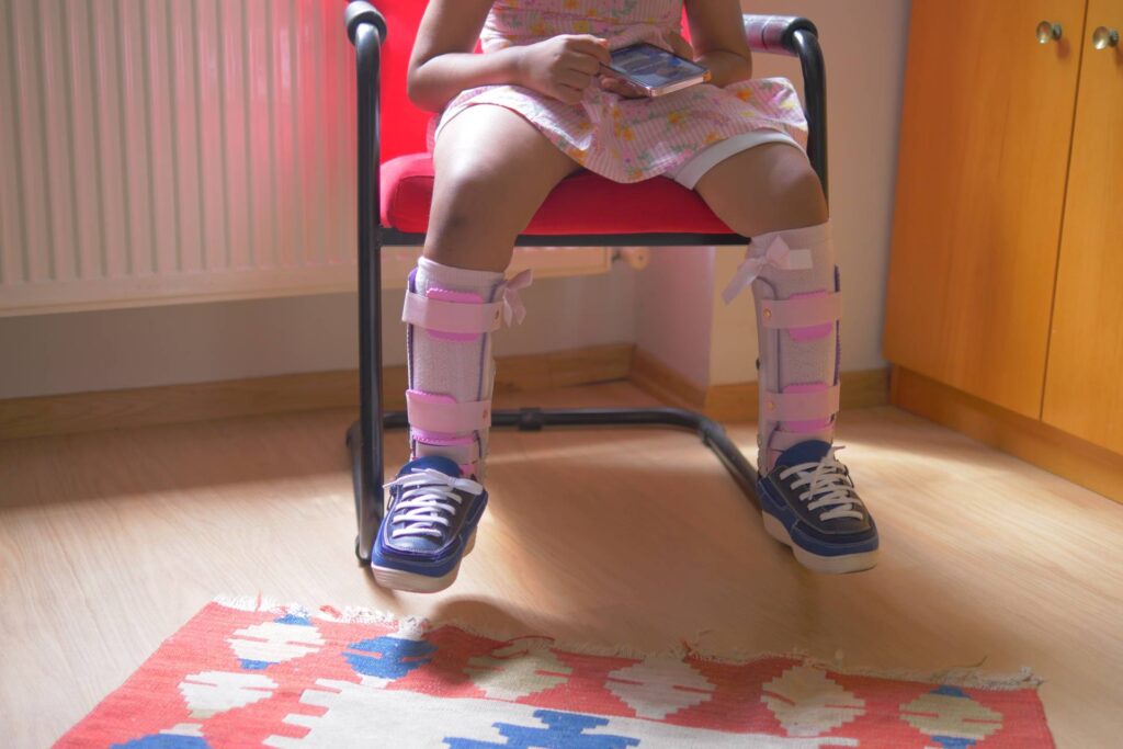 Child cerebral palsy disability, legs orthosis.