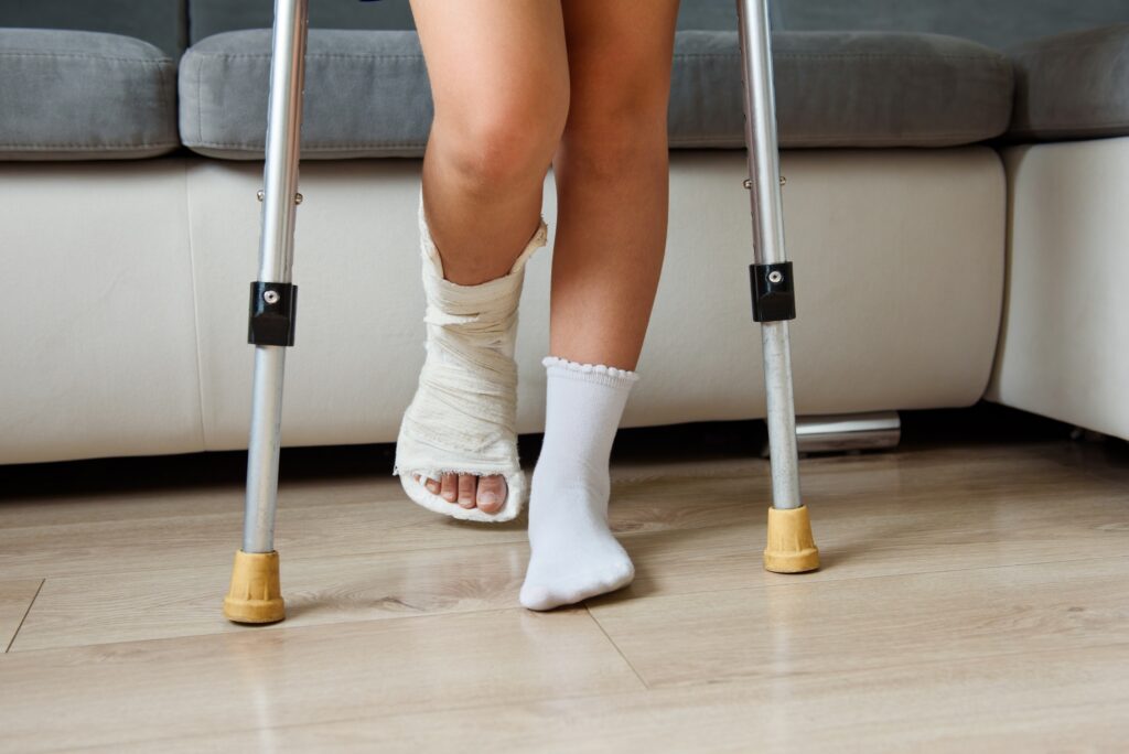 Child,With,A,Cast,Leg,On,Crutches